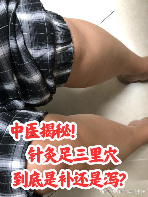 成都针灸推拿哪里好