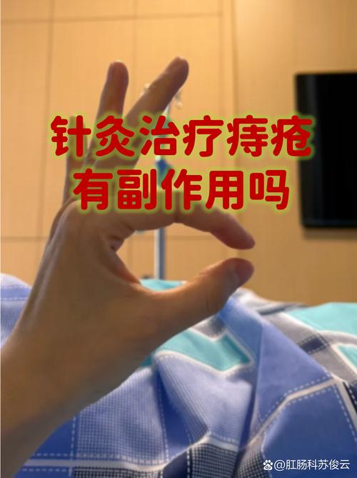 针灸真能治好痔疮吗