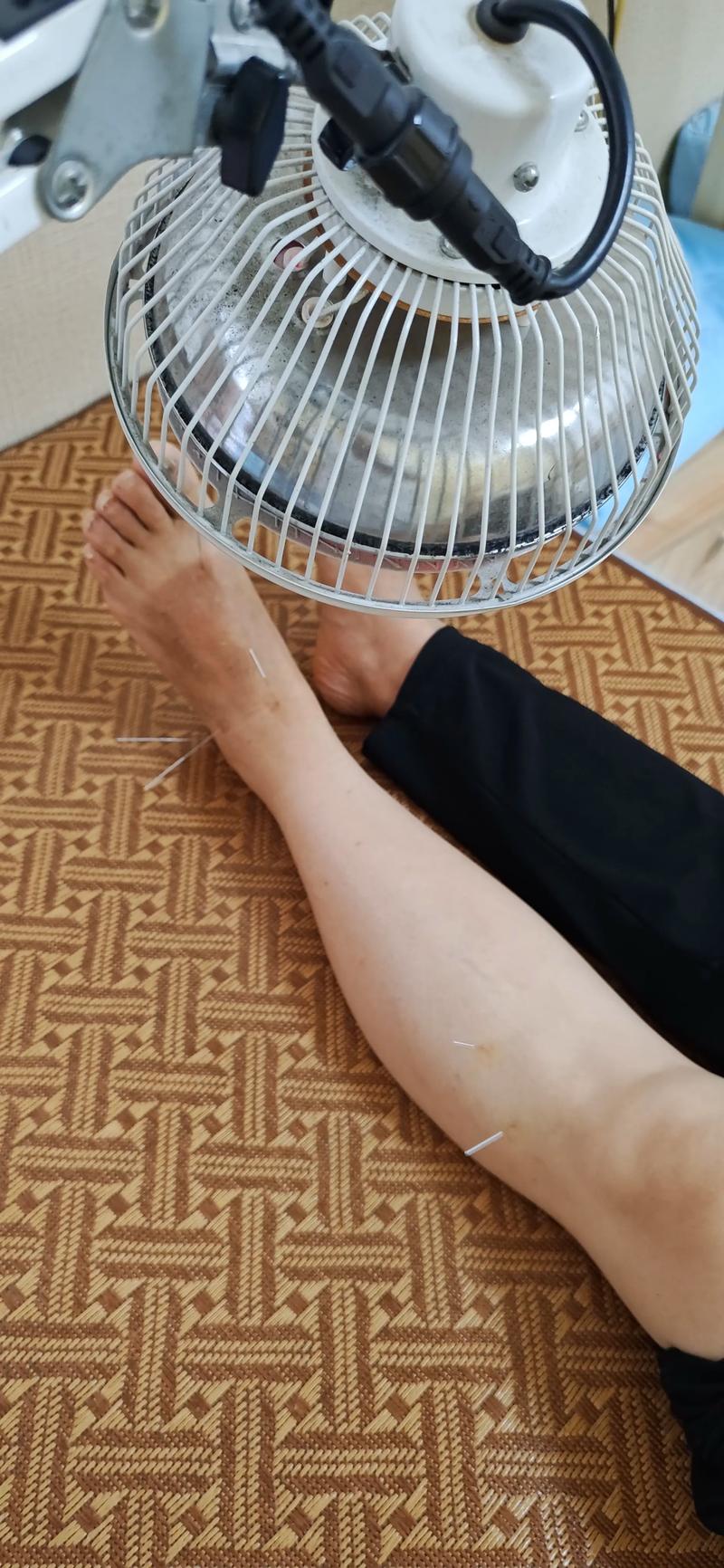 脚扭伤中医针灸治疗