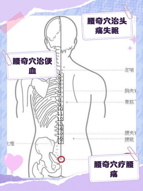 腰部针灸起什么作用
