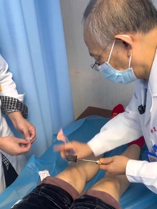 滑膜炎针灸治疗视频