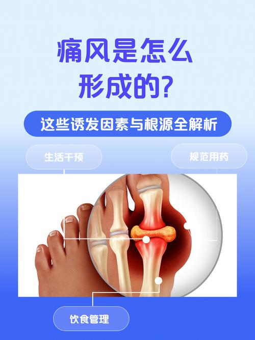 痛风为什么在夜间发作