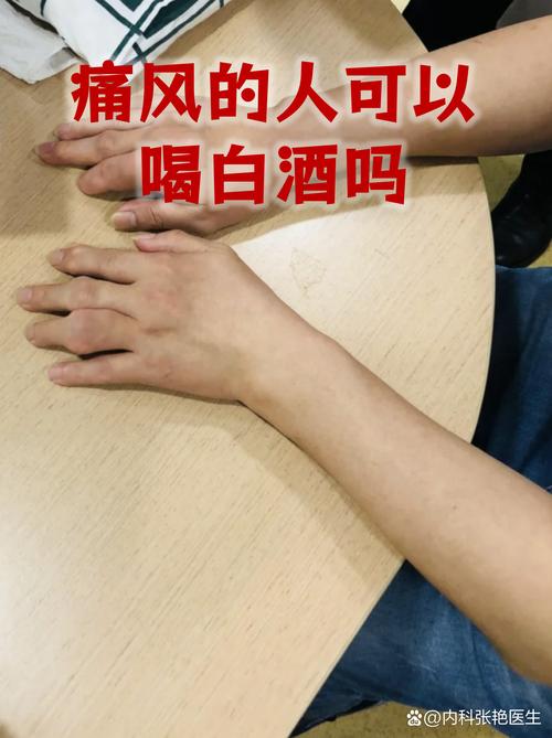 痛风好了可以喝白酒吗