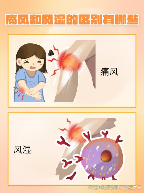 痛风是骨头疼还是肉疼