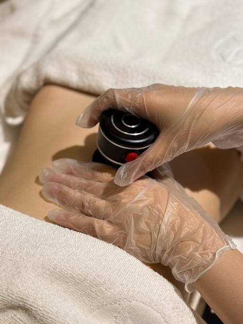 日日瘦隐形针灸效果