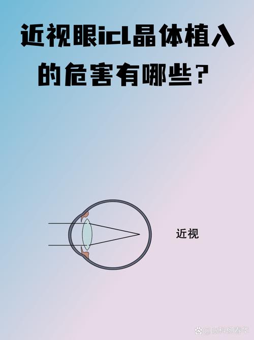 现在近视眼手术安全吗