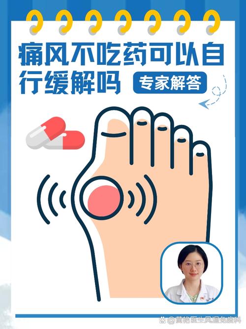 痛风发作不吃药能好吗