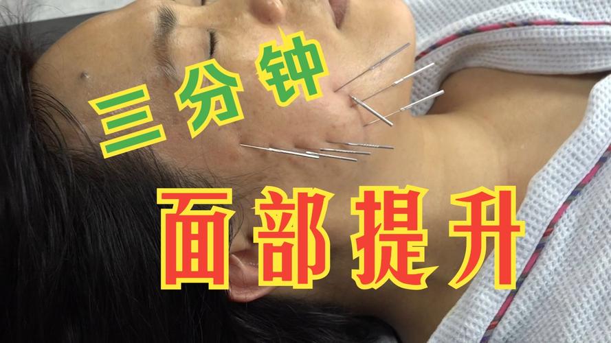 怀孕可以面部针灸吗