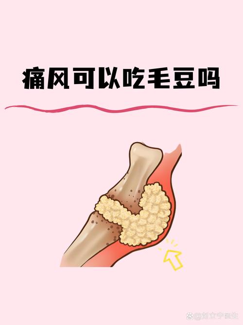 毛豆痛风的人可以吃吗