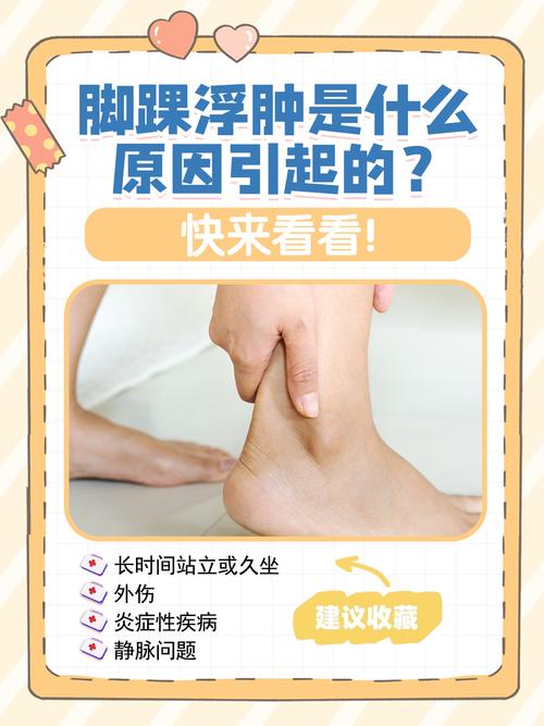 痛风脚脖子肿了怎么办