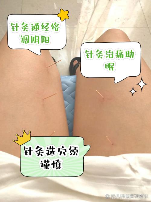 宫颈囊肿可以针灸吗