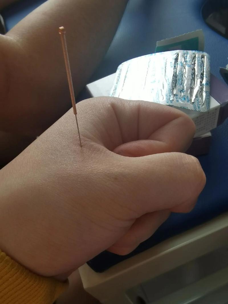 张中一 针灸 新浪