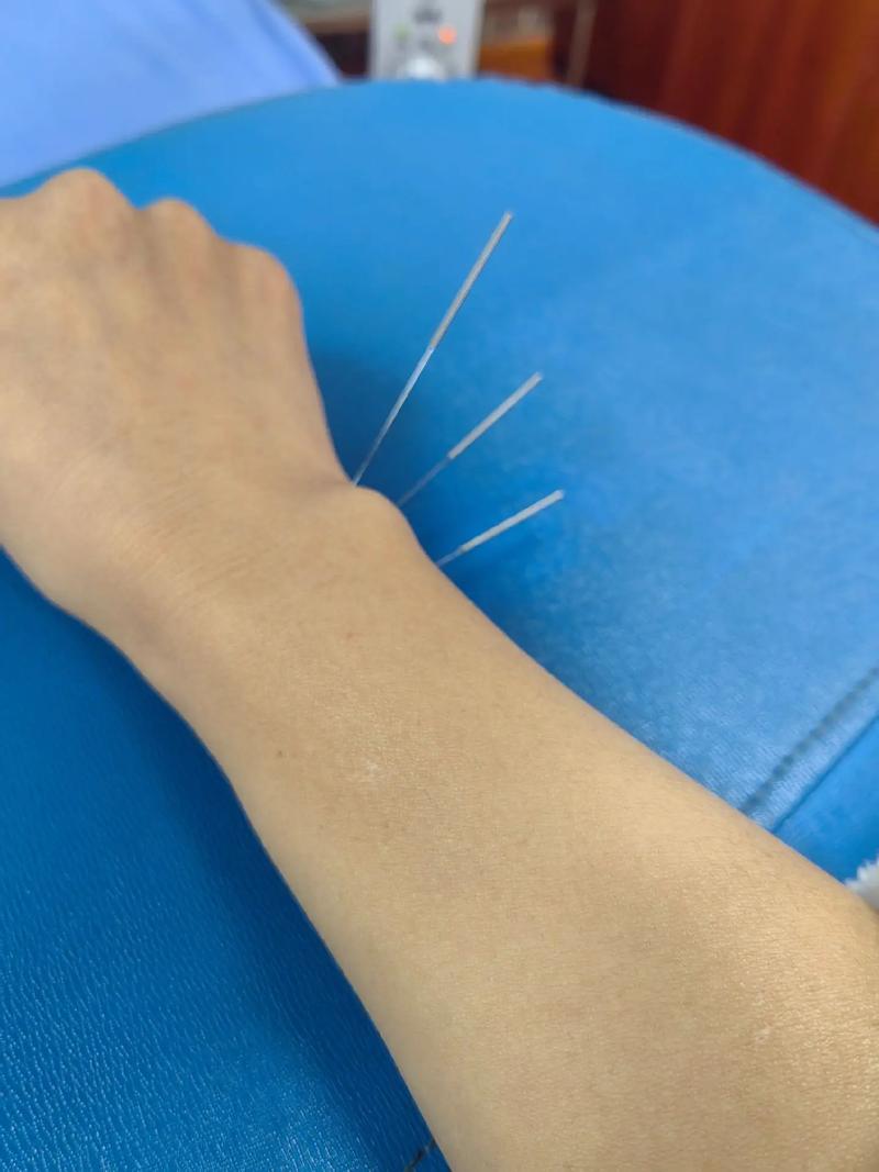 张中一 针灸 新浪