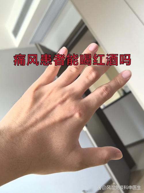 痛风患者可以喝红酒吗