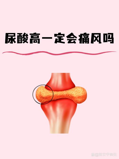 尿酸高就一定是痛风吗