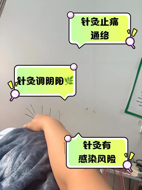 腰肌劳损针灸有用么