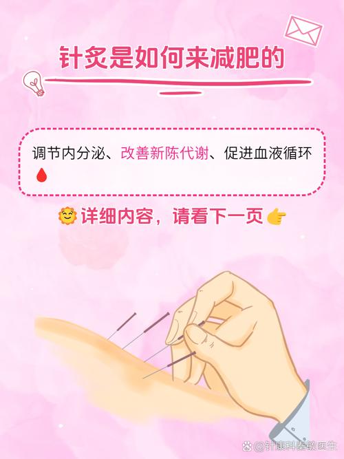 在哪可以学针灸减肥