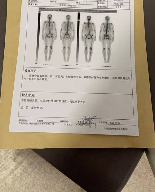骨扫描后隔离几米安全