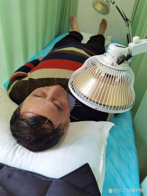 面瘫针灸后耳朵酸痛