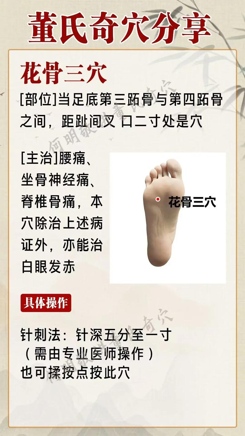 脚跟痛针灸哪里图解