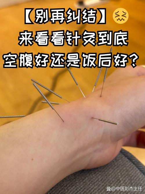 沈阳铁西针灸哪里好