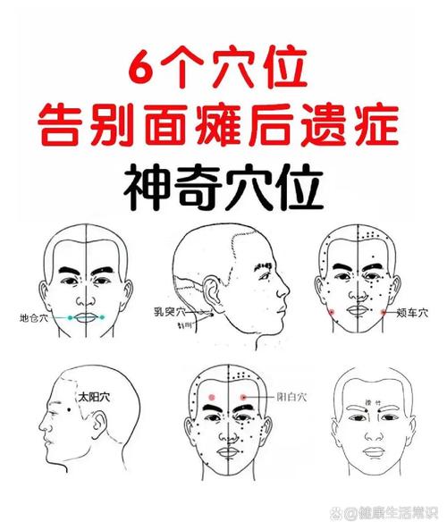 针灸治疗面瘫啥原理