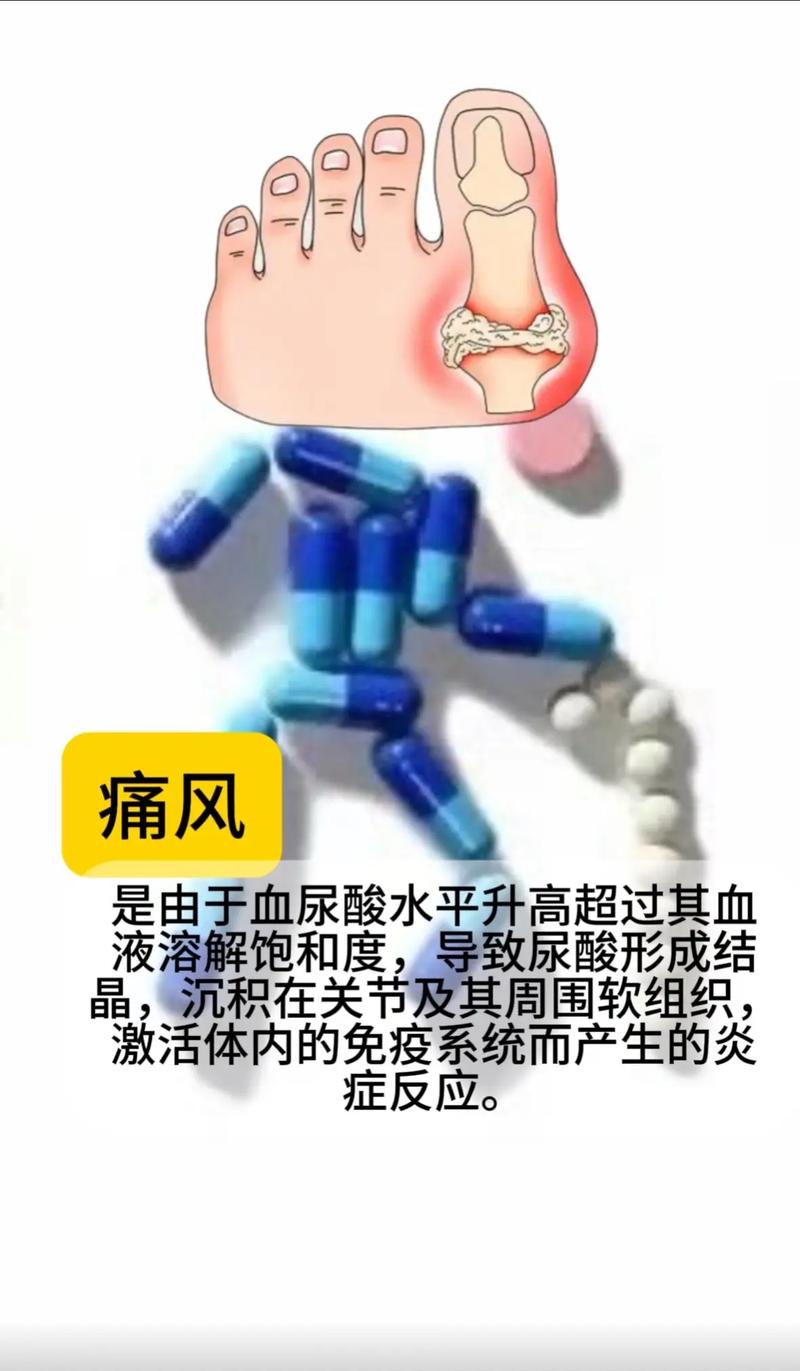 痛风疼的受不了怎么办