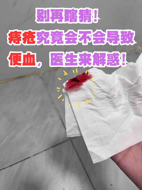 痔疮便血兰州东大安全