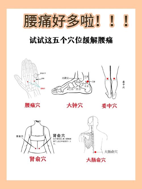 针灸多久可以治腰疼