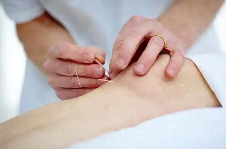 为什么经期不能针灸