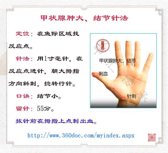 针灸治疗甲状腺疾病