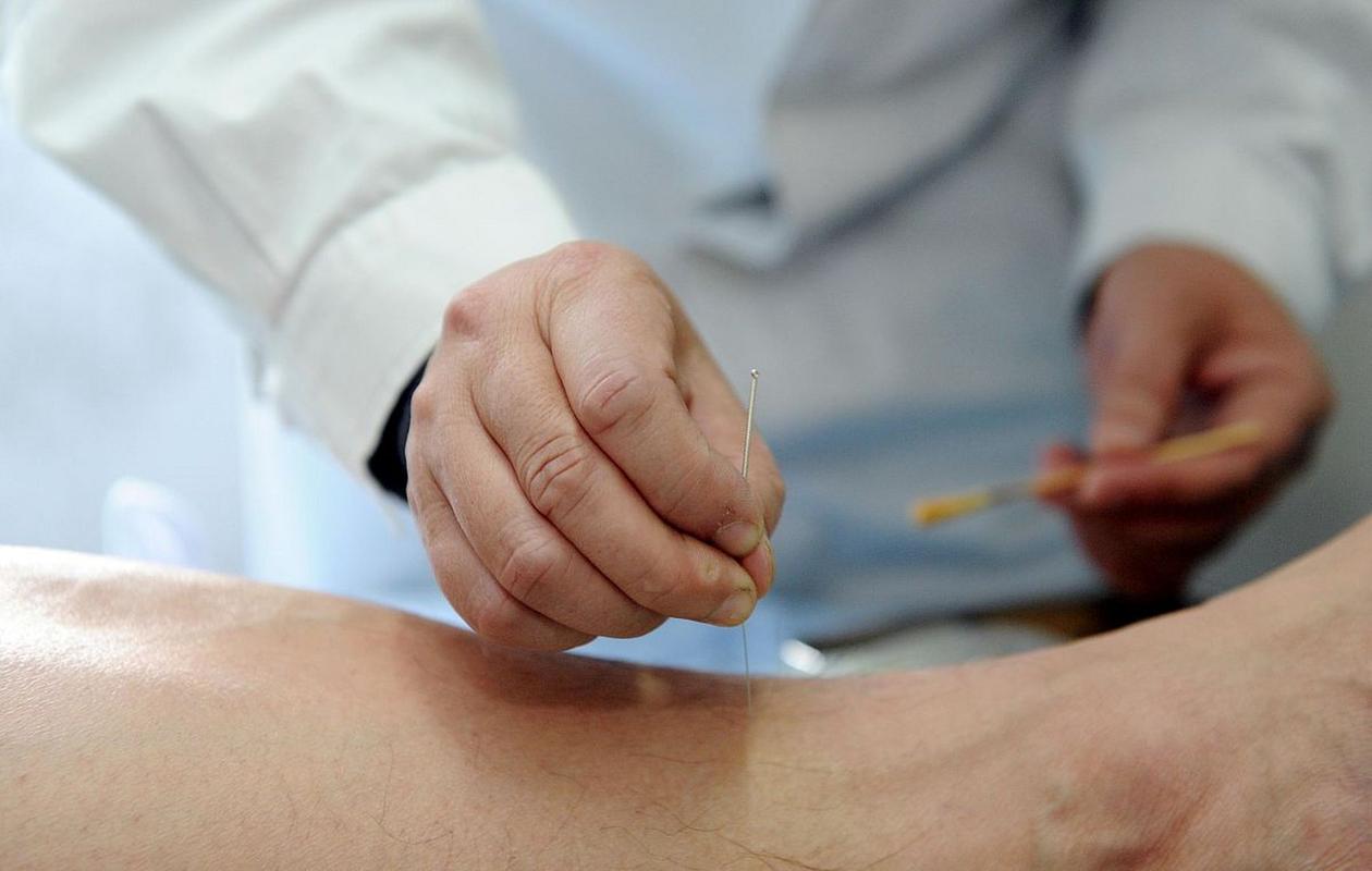 针灸治疗甲状腺疾病