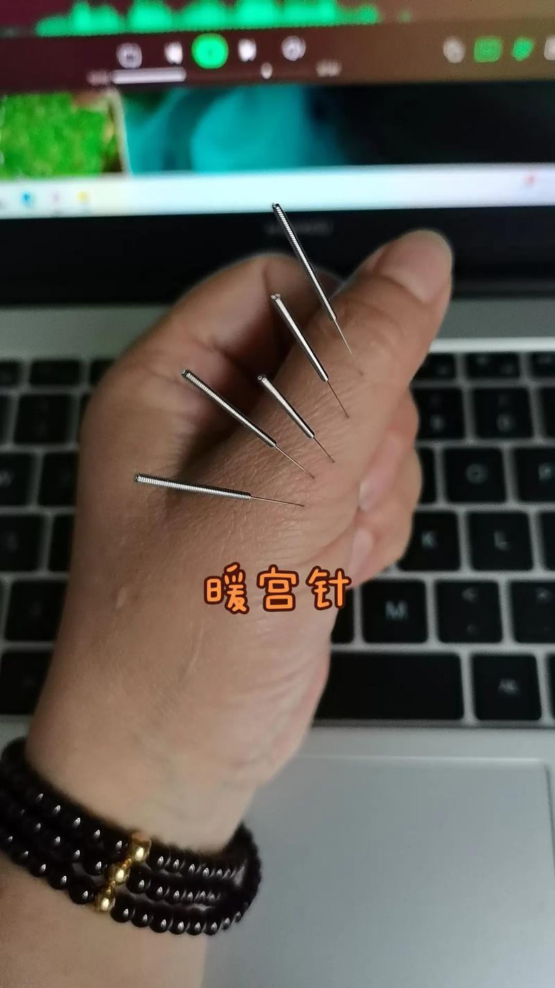 宫外孕保守治疗针灸