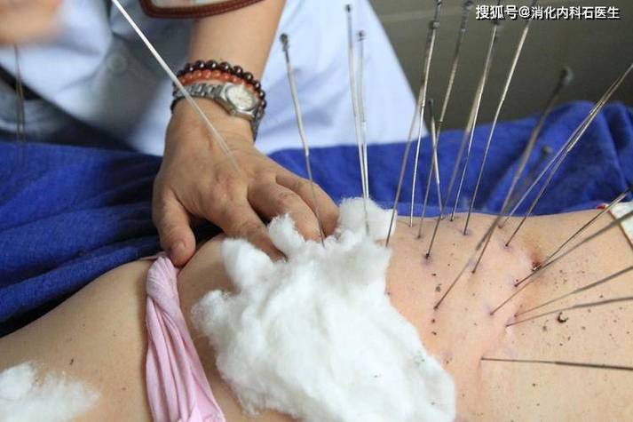 宫外孕保守治疗针灸