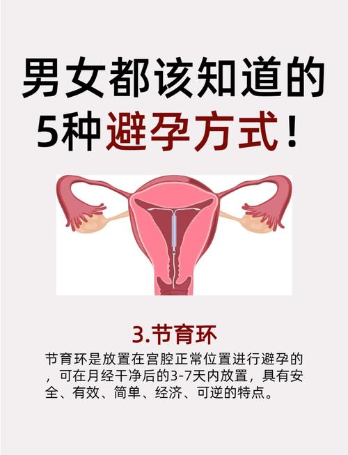 安全的避孕方法有哪些