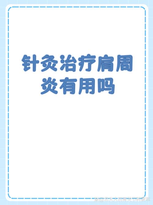 针灸肩周炎效果好吗