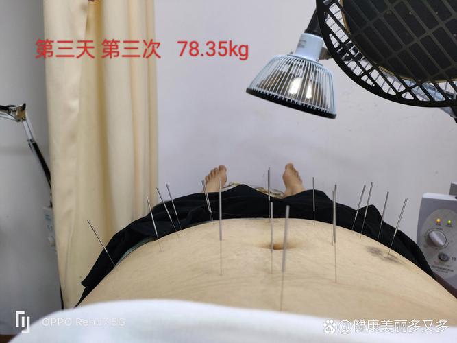 小腹气血不通 针灸