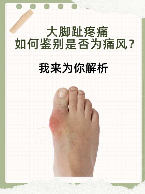 脚痛风什么东西不能吃