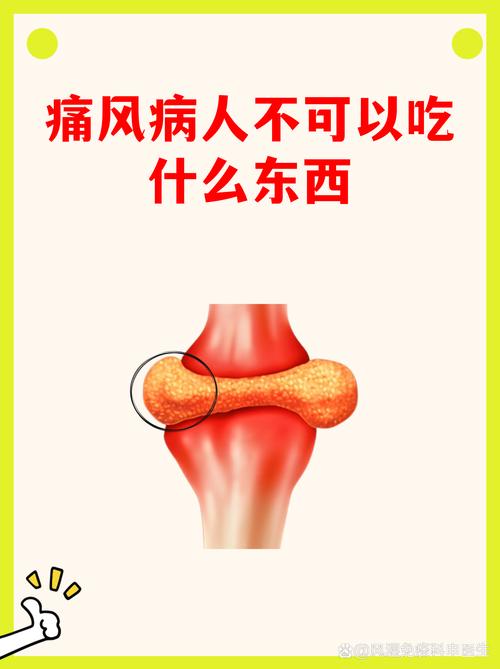 脚痛风什么东西不能吃