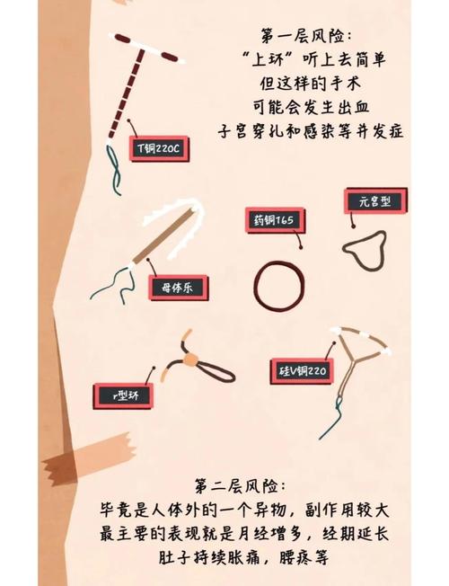 不能带环怎么避孕安全