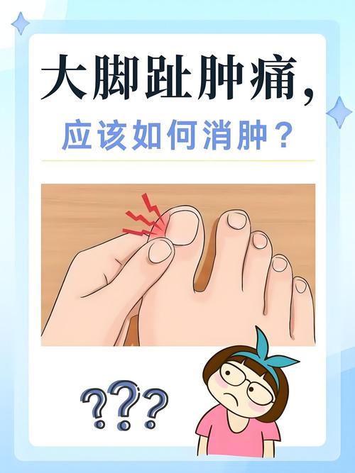 痛风脚趾头肿痛怎么办