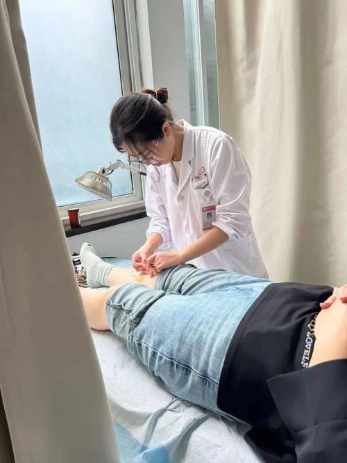 香山医院 针灸减肥