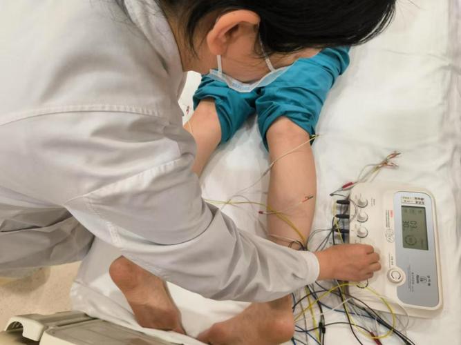 针灸电疗 什么感觉