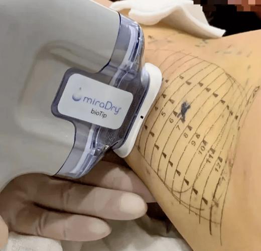 苏州腋臭手术安全康立