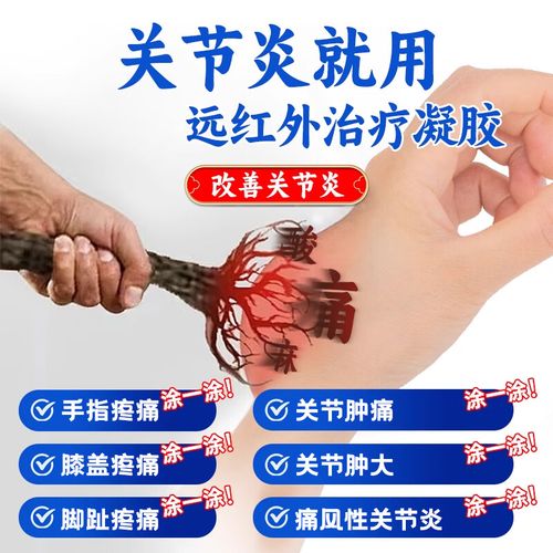 痛风性关节炎怎么治疗