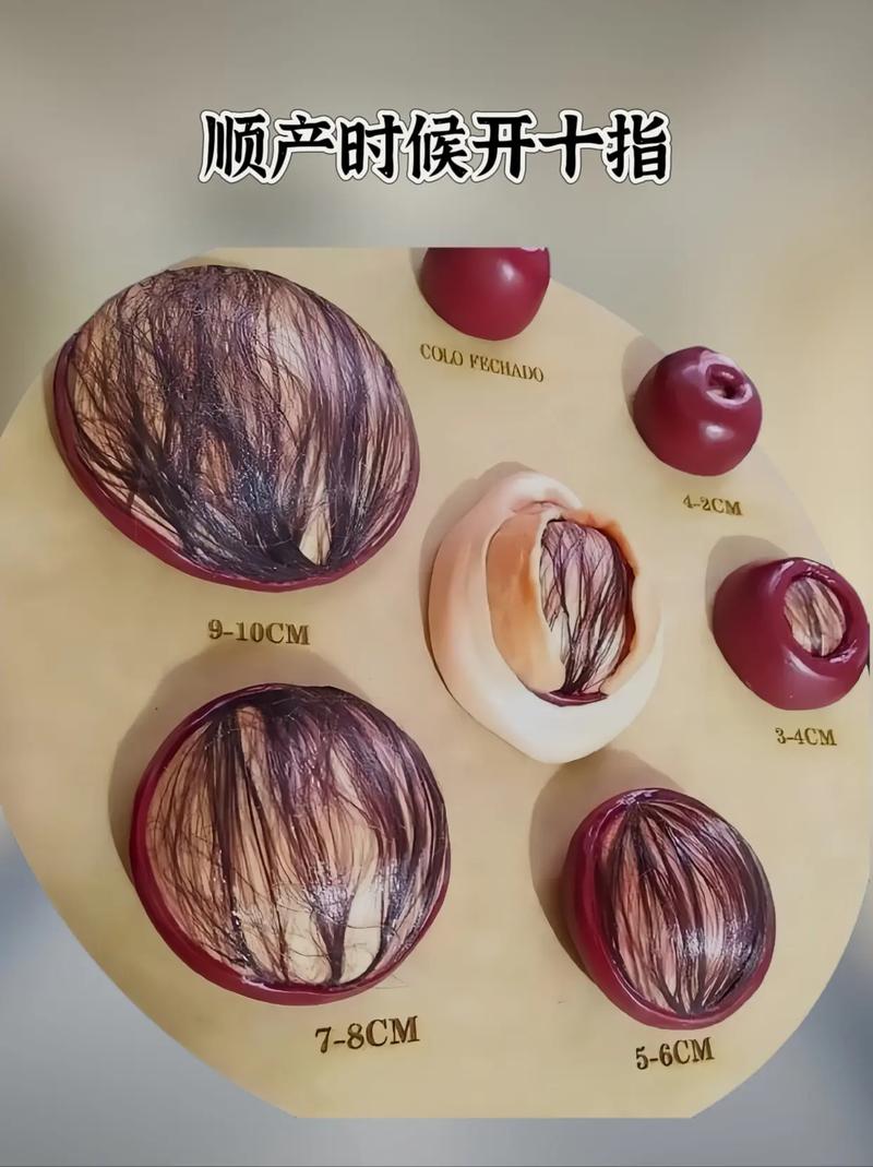 宫口全开多久生是安全