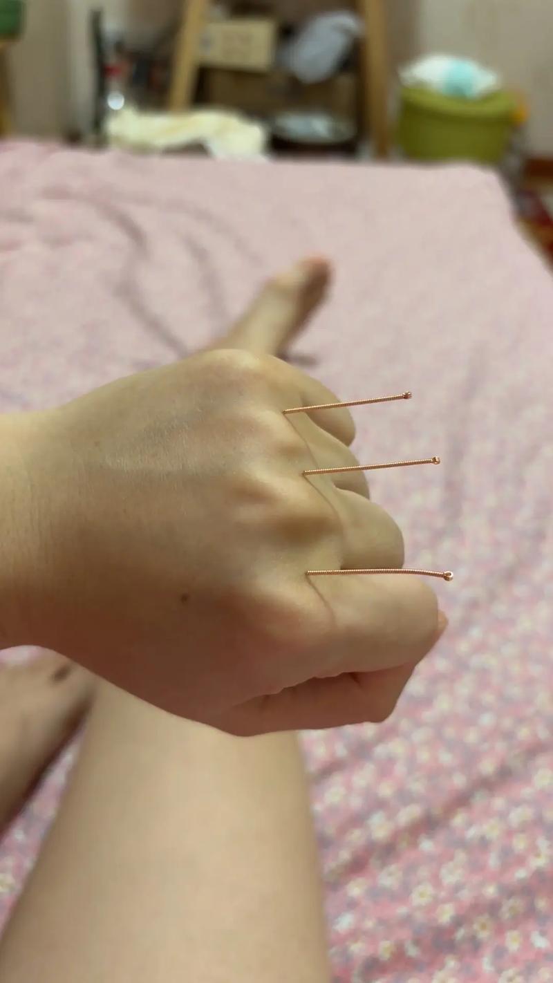 三叉神经扎针灸扎哪