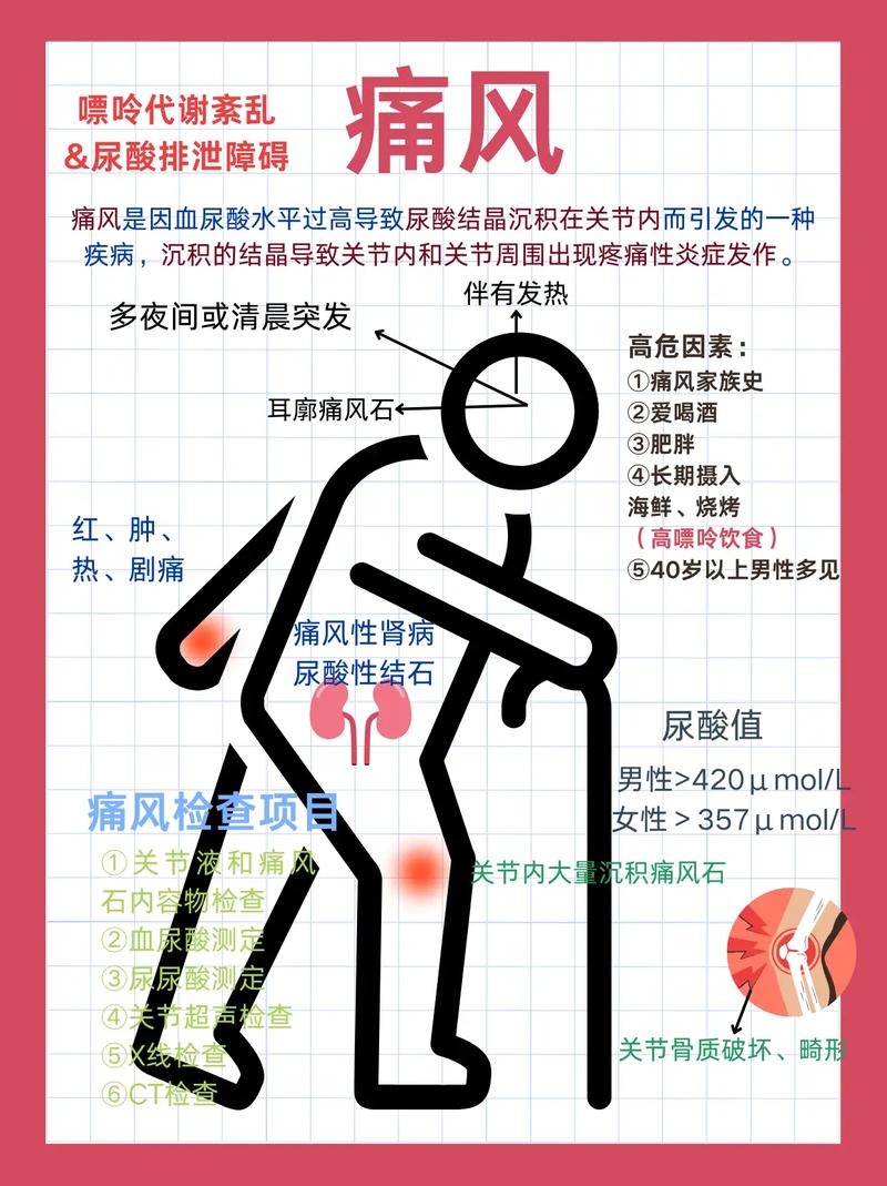 痛风即将发作怎么处理