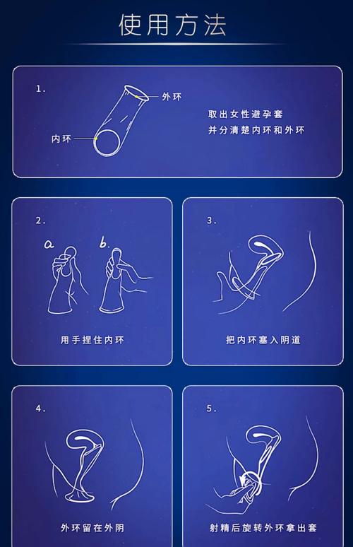 目前最安全的避孕方法