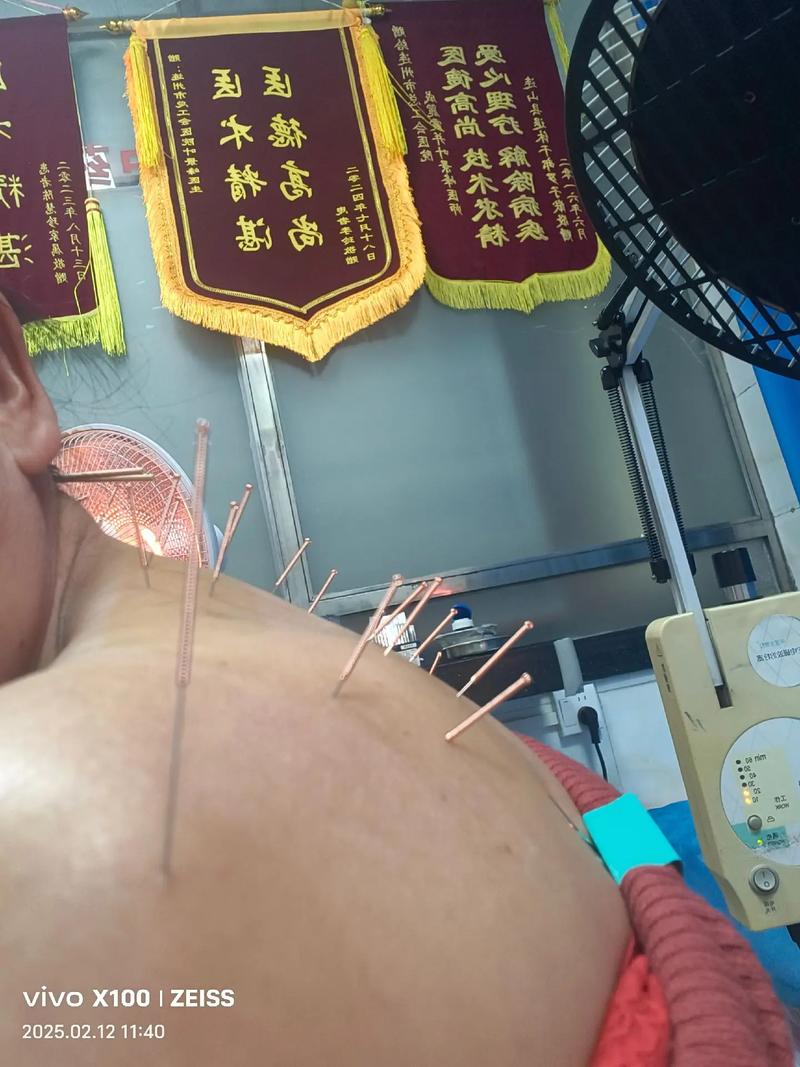 南阳有名气的针灸师
